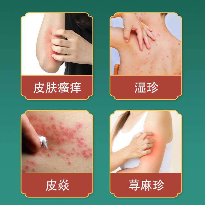 李時珍国医石貞百花膏石珍皮膚看護皮膚掻痒外用かゆみ止めクリーム源メーカー|undefined