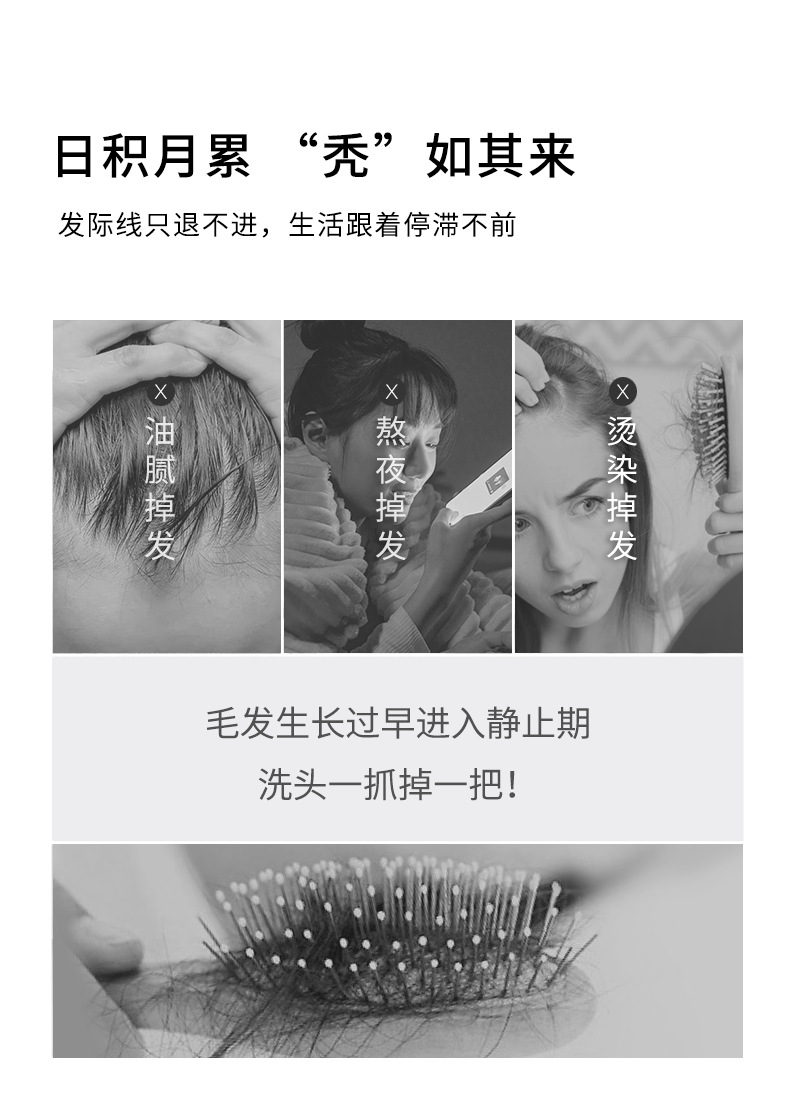 SKT生姜去屑洗发水去屑止痒改善毛躁轻盈蓬松洗发露 防脱洗发水