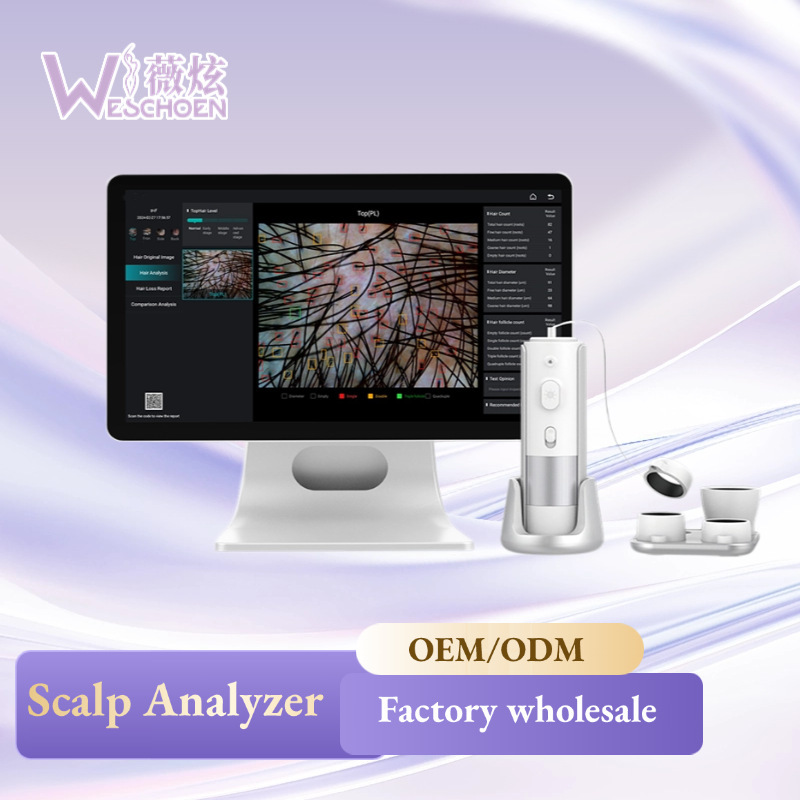 Professional Scalp analyzer Scalp diagnosis head skin care|undefined