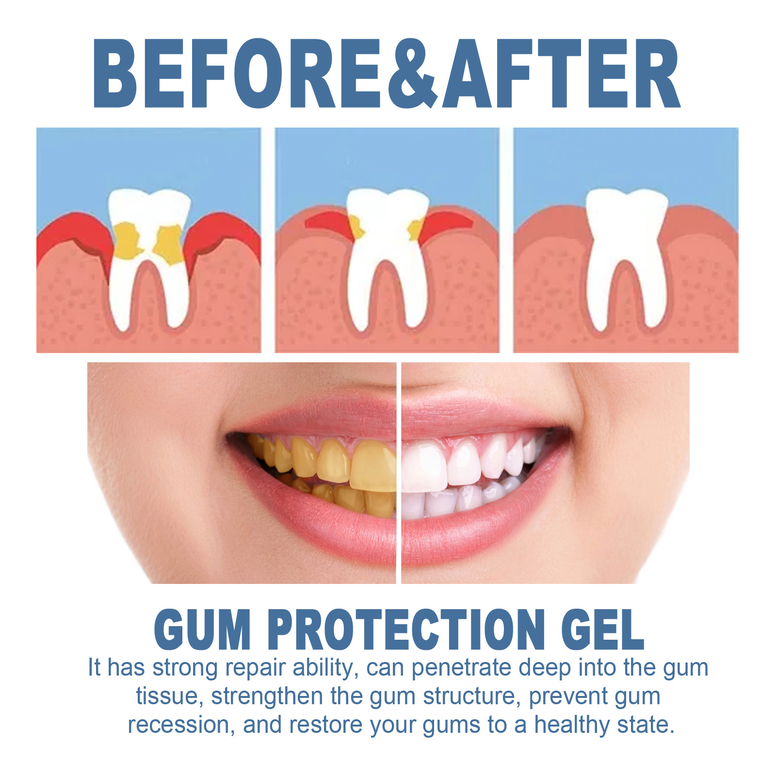 Teeth Repair Gel Image 7