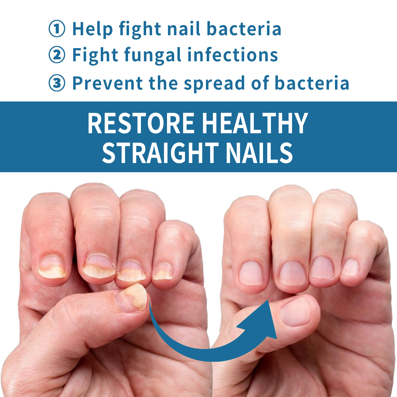 EELHOE smoothing essence soft thickening nail care liquid_voghion.com