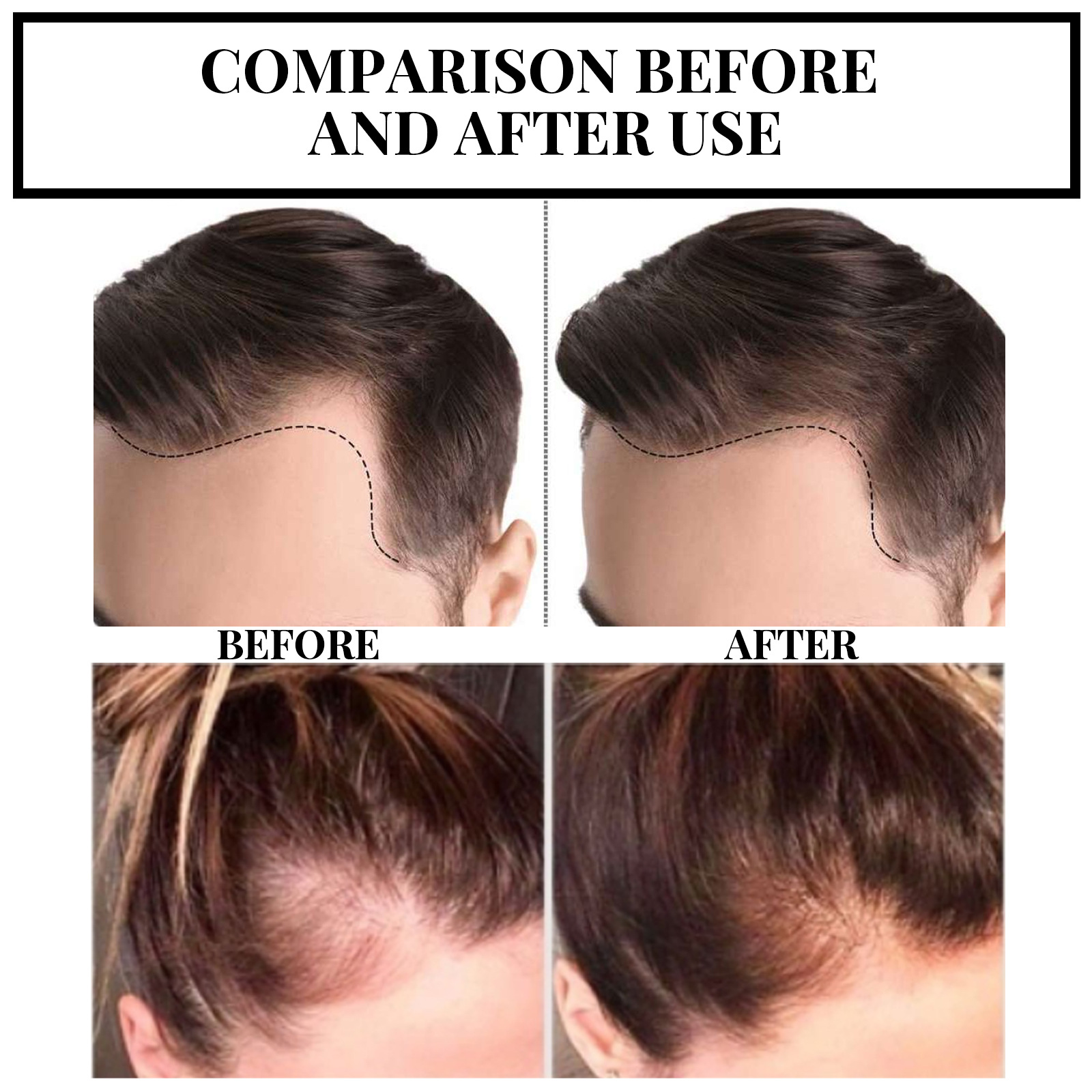 EELHOE Óleo Essencial Longo Denso Suave Seda Gengibre Essência Condicionador de Cabelo_voghion.com