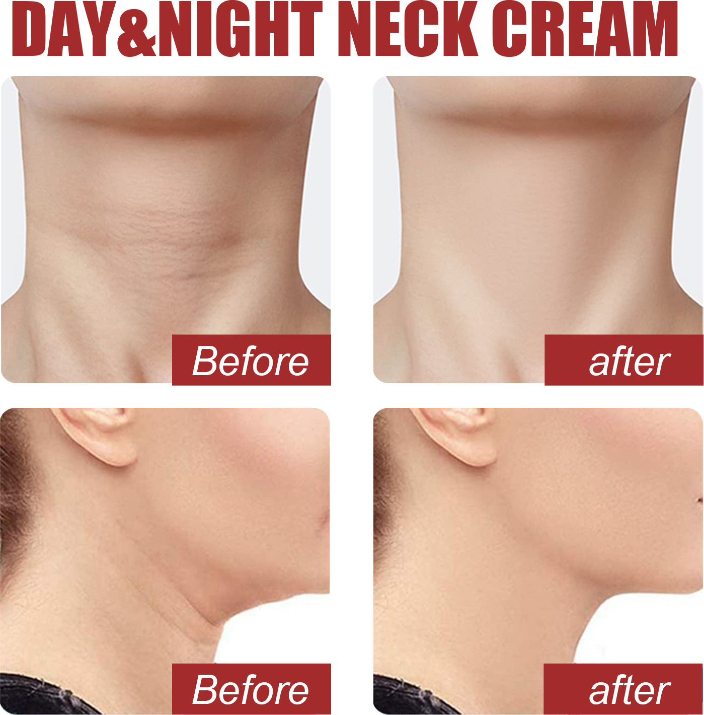Retinol Collagen Complex Neck Cream For Lifting And Firming Skin_voghion.com