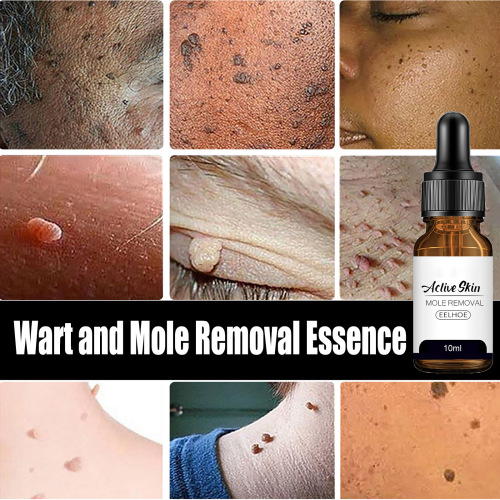 EELHOE Spot Mole and Wart Essence Skin, Face, Armpits, Neck Removal, Repair, Cleansing and Care