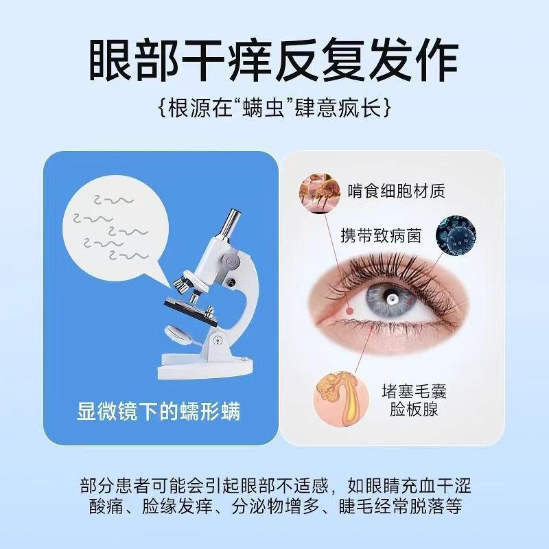 茶树精油除螨湿巾眼贴眼部专用4松油醇眼睛螨虫眼睑清洁眼干眼痒|undefined