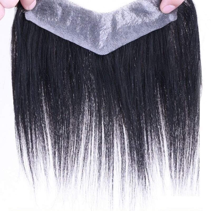 Hairline Wig Stickers for Men's Forehead M-Shaped Real Hair Biological Scalp Invisible Traceless Forehead Replacement Fake Bangs Hairline Wig Stickers for Men's Forehead M-Shaped Real Hair Biological Scalp Invisible Traceless Forehead Replacement Fake Bangs