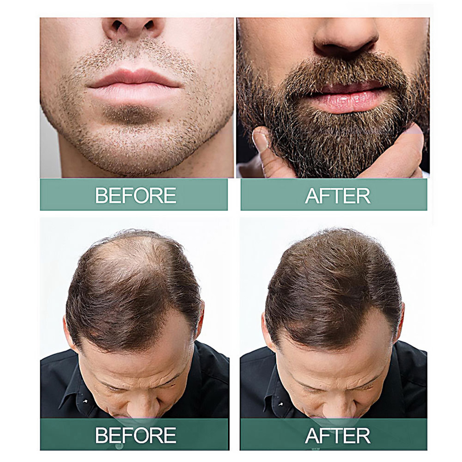 East Moon 7 Day essence Line Anti drop Dense Growth Scalp Root Hranljivo eterično olje za nego las_voghion.com