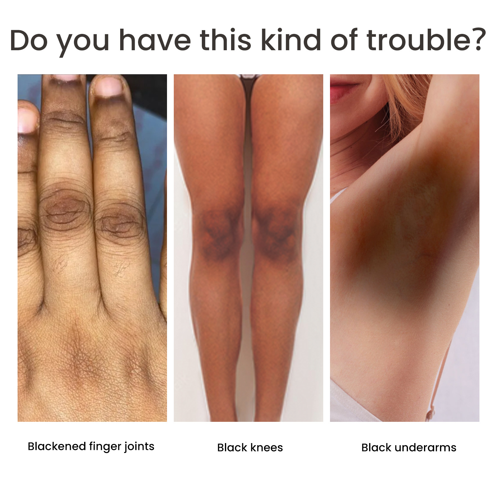 West&Month Skincare Body Joint Elbow Whitening Moisturizing and Brightening Skin Tone Cream_voghion.com