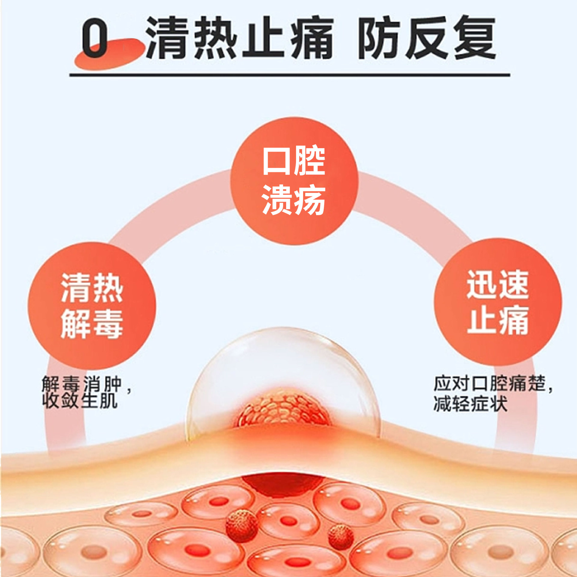 Spray para úlceras orales y úlceras en la lengua, dispositivo médico de clase II, úlceras orales