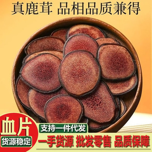 ¹��Ƭ¹��ѪƬ  ���x�L��ɽ�t��Ƭ���ݾ��Ҝ���¹���DƬ�ɴ��l