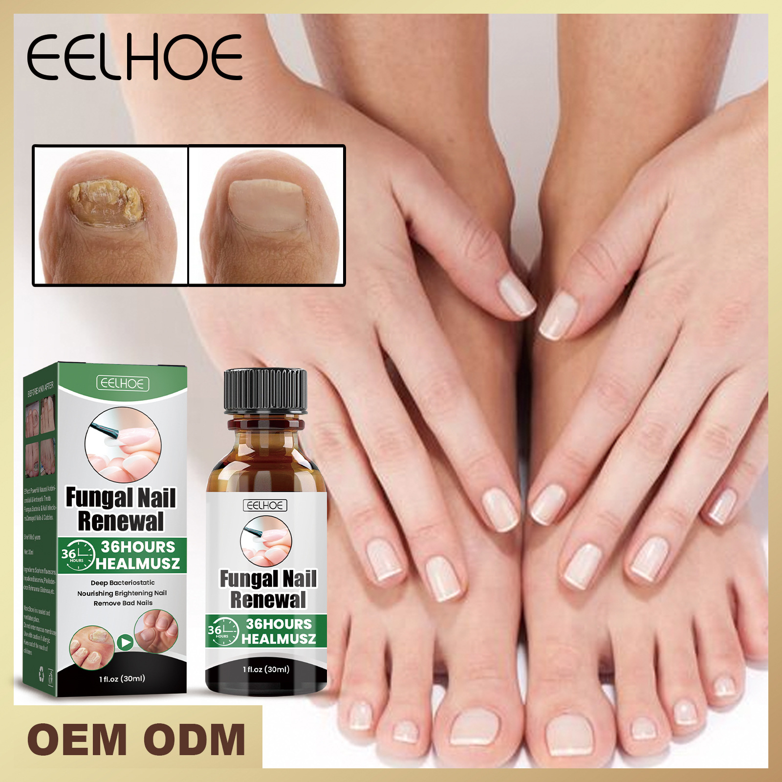 EELHOE Foot Care Grey Removal Damage Dicke und helle Nagelreparaturflüssigkeit_voghion.com