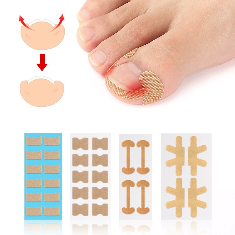 Самоклеящаяся эластичная наклейка для коррекции ногтей на ногах для ремонта ногтей