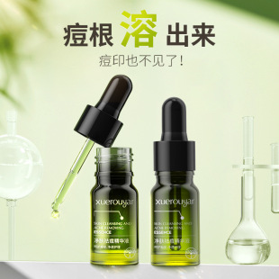 ѩ����С�Gƿ���w����AҺˮ�����ԭҺ�տsë���������Һ