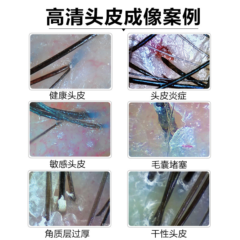 頭皮検出器毛包分析皮膚検出器写真固定頭皮理学療法器美容院頭皮分析|undefined