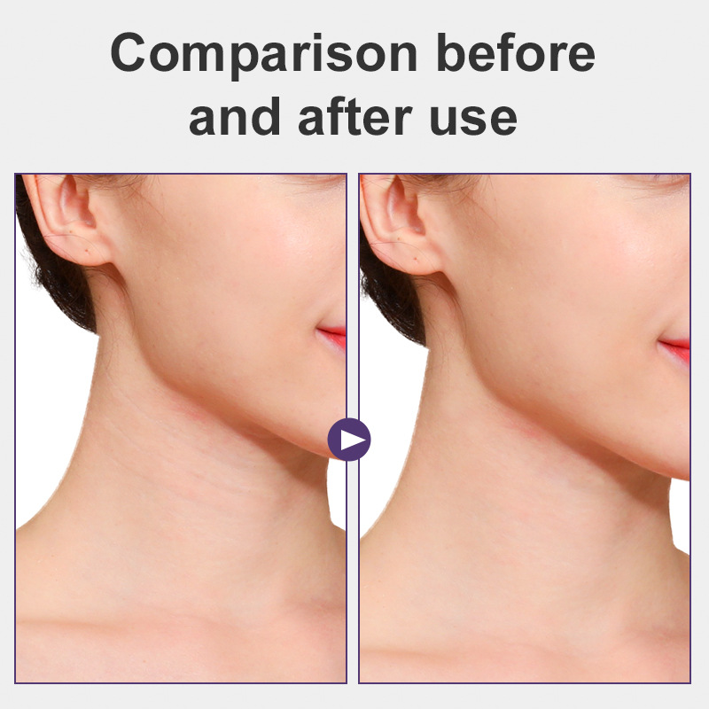 Parche invisible para arrugas del cuello que levanta las arrugas del cuello, desvanece y reafirma la piel, ajusta automáticamente sin irritación de la piel.