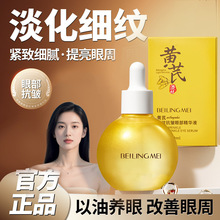 �S�ξ��A��Һ�沿�۲���Ħ���������o�o�����ܲ��o�w����
