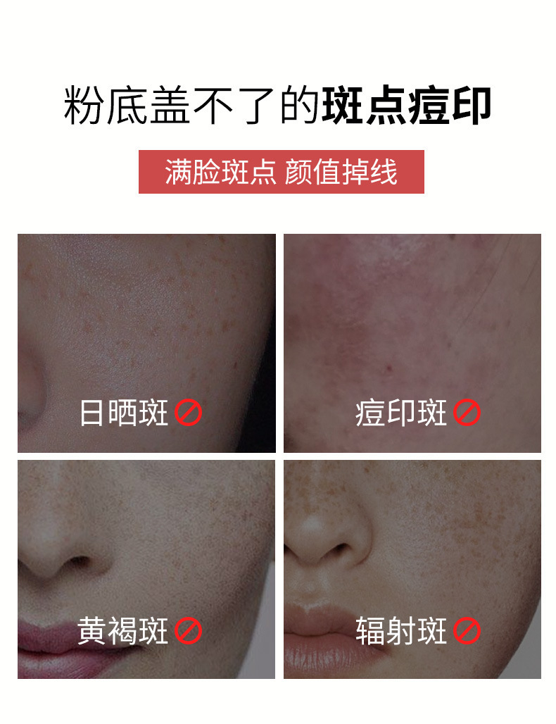润凰幽爽臻白祛斑乳霜一笔祛斑淡化痘印焕亮皮肤改善暗沉贴牌_各有所爱 