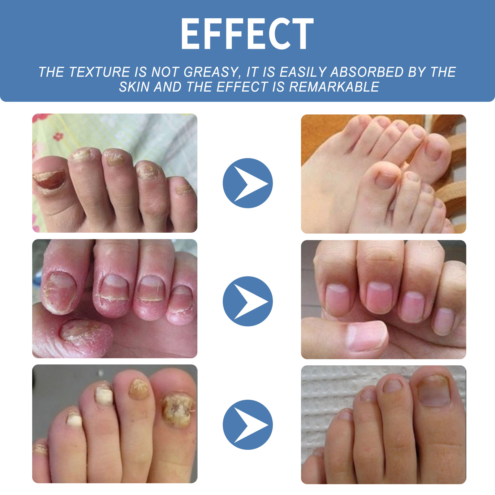 Nail Care Gel Image 7
