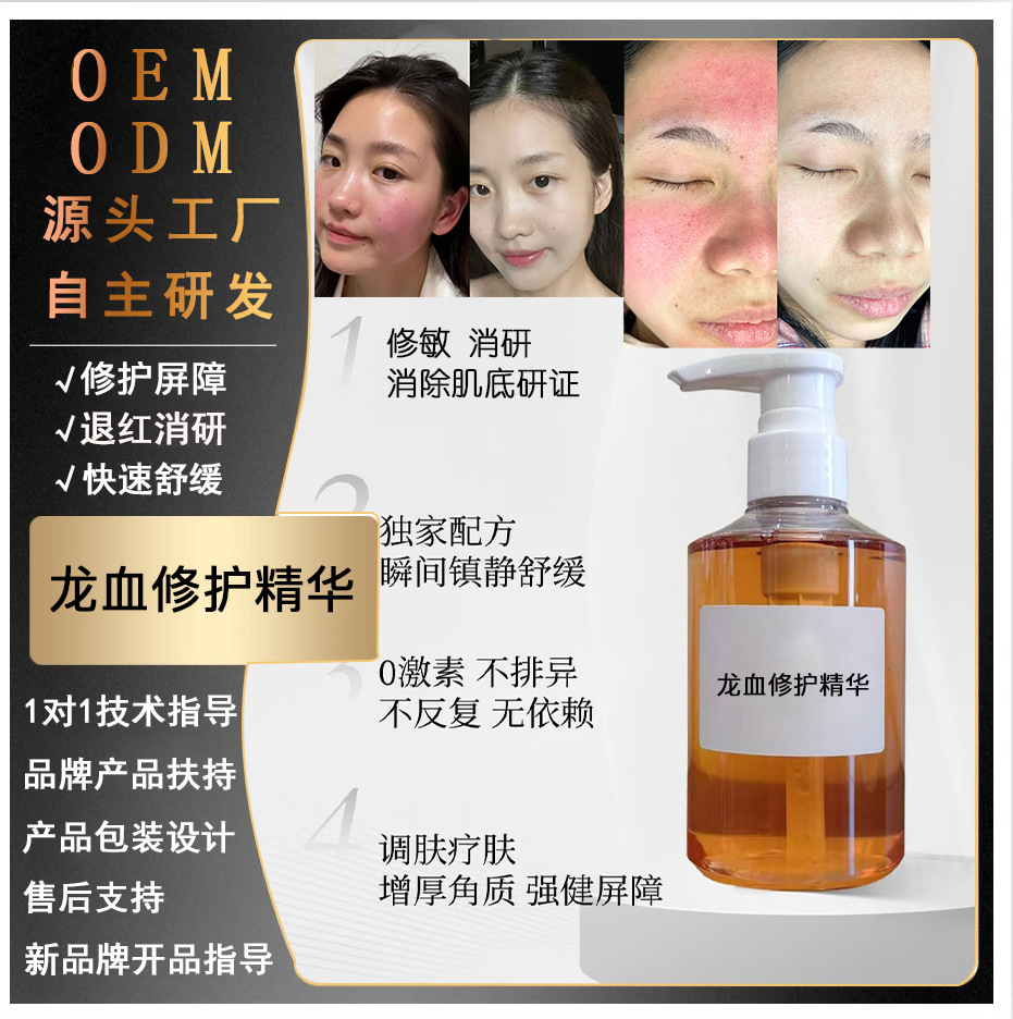 美容院脸部敏感肌退红过敏烂脸修护面霜院用红肿痒修护精华液