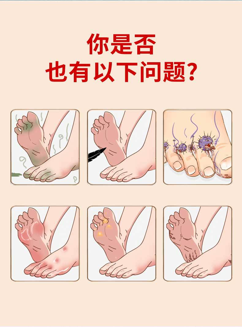 Yunnan Herbal Antibacterial Cream for Dry Cracked Hands and Feet Skin Care 50g overview