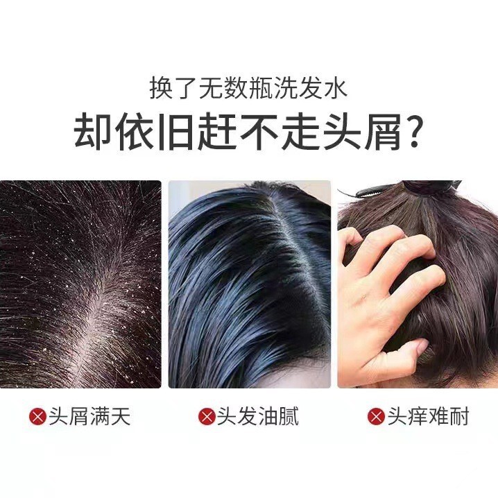 澳洲selsun洗发水200ml硫化硒去屑止痒修护洗发水男女滋养洗发露|undefined