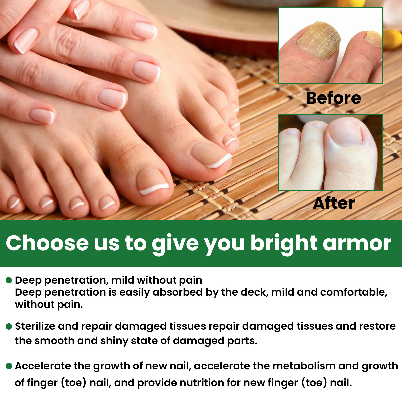 EELHOE Foot Care Grey Removal Damage Dicke und helle Nagelreparaturflüssigkeit_voghion.com