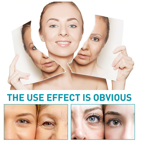 EELHOE Aqua-Light Cono Peptide Anti-Wrinkle Essence Firms Wrinkles, Crow's Feet, Nasolabial Folds, Beautifies and Repairs Skin