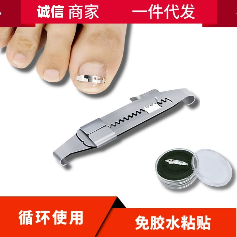 Fanzhuang справедливая броня пряжка для физических растяжек