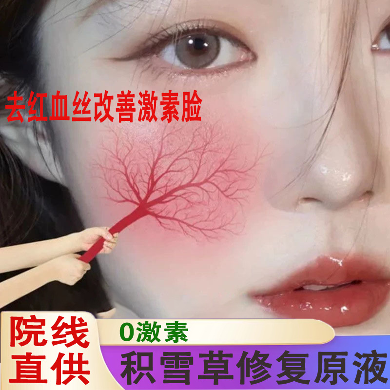 激素脸修复液改善敏感肌增厚角质层退红去红血丝积雪草修护精华液