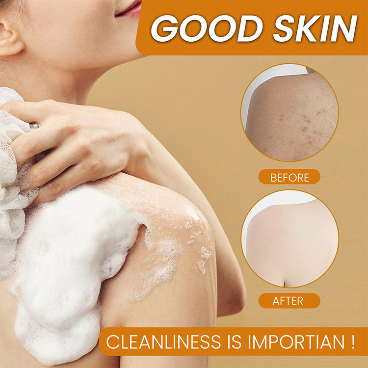 Jabón Artesanal de Jengibre y Ácido Kójico para Comercio Exterior, Jabón Limpiador de Nicotinamida y Limón, Jabón para Baño, Jabón para la Piel, Jabón Hecho a Mano con Aceites Esenciales