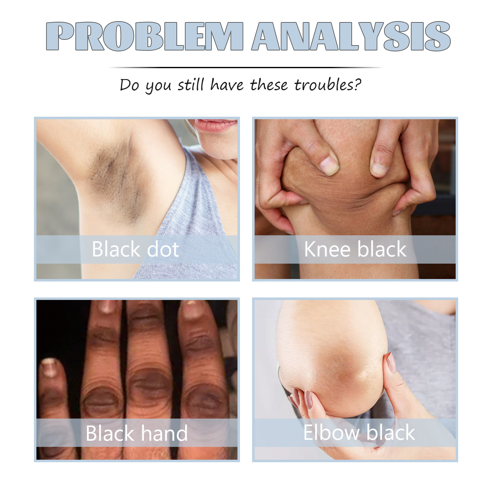 Dunkle Flecken Acanthosis Creme Zur Hautaufhellung Und Pflege_voghion.com