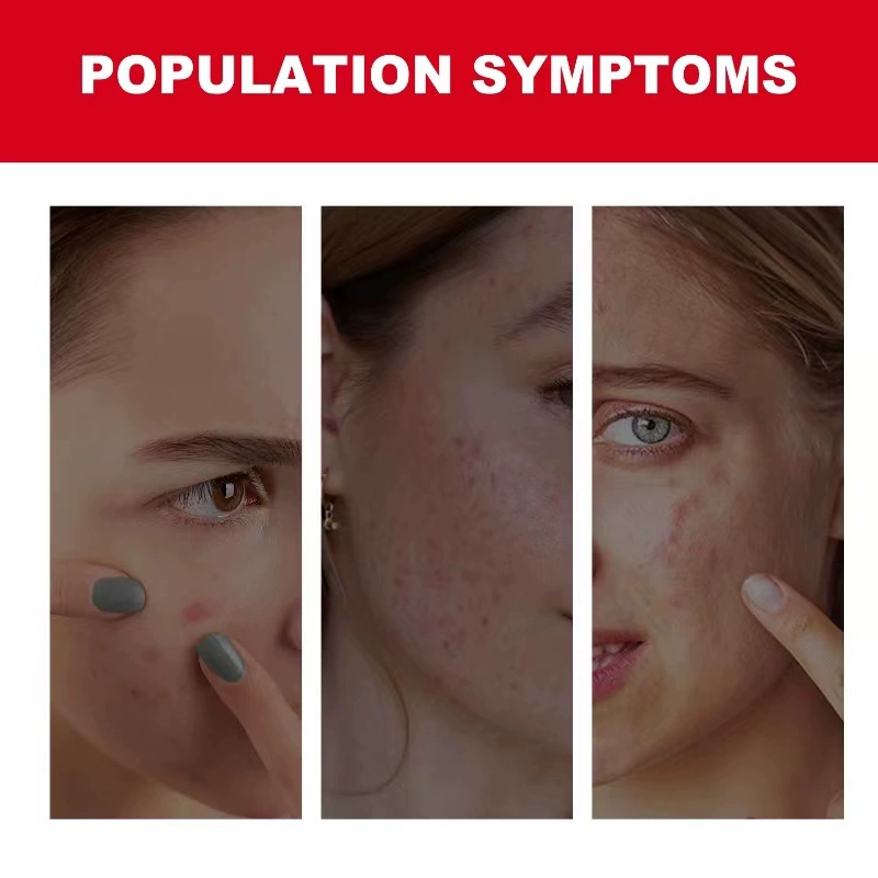 Акне-патч (OEM/ODM) прозрачное незаметное покрытие от blemish, 24 пластины, индивидуальный логотип