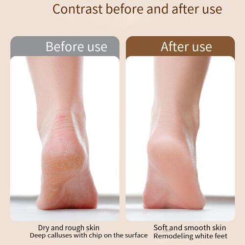Pedicure machine to remove dead skin and calluses, home fully automatic electric foot grinder, quartz stone pedicure machine to remove calluses