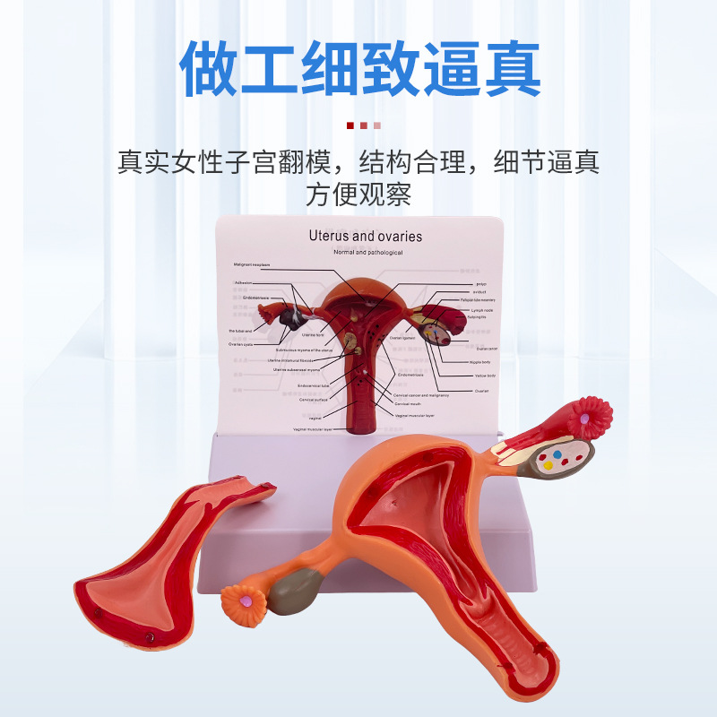 ҽѧŮ���ӹ�ģ���ѳ���ֳ�ṹ����ģ�͸��Ƹ������ѳ��ӹ�ģ��