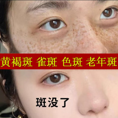 シミ取りクリーム、甘草定フェイスクリーム、黒ずみクリーム、そばかす・肝斑コントロールクリーム377、美白・シミ取りクリーム