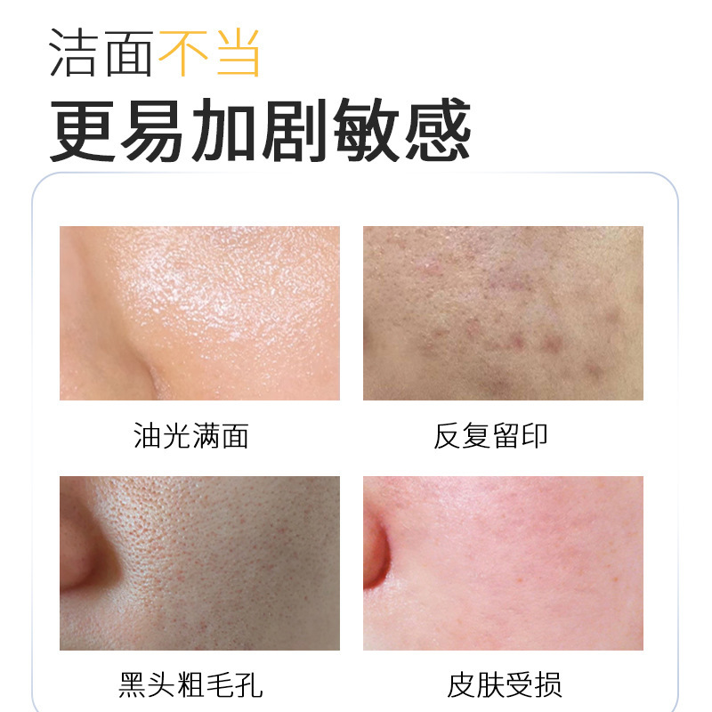 琪瑟氨基酸双管洗面奶净透毛孔控油祛痘洁男女士通用洁面乳|undefined