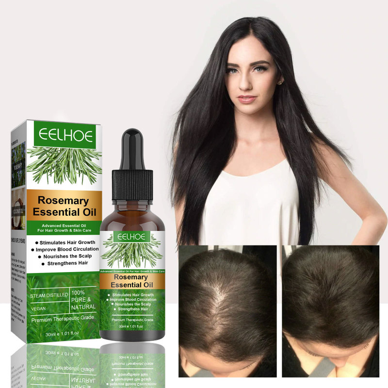 EELHOE ローズマリー オーガニック ヘアケア エッセンシャル オイルは髪の成長を強化し、改善し、抜け毛を防ぎ、頭皮に栄養を与えます。|undefined