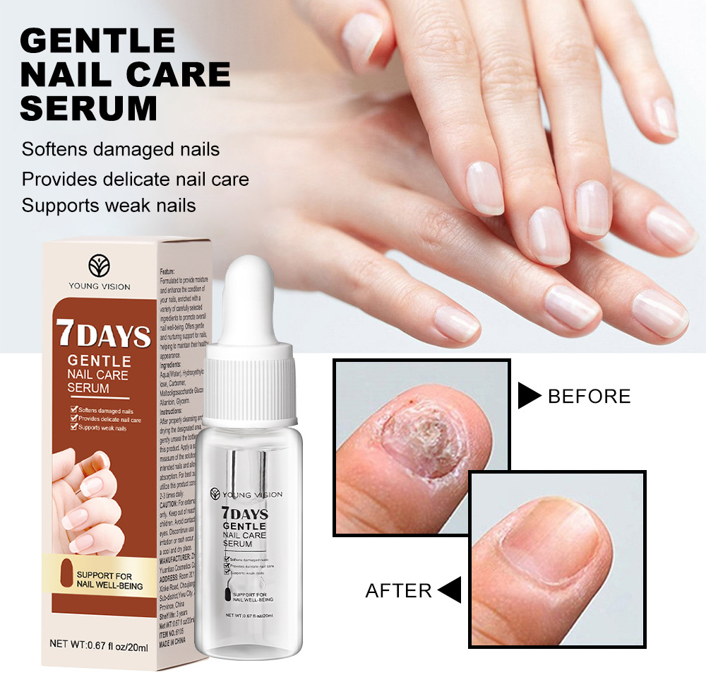 YOUNG VISION Nail Essence Beauty Nail Liquid undefined