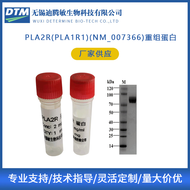 人源重组蛋白PLA2R(PLA1R1)(NM_007366纯化磷脂酶透明质酸迪腾敏