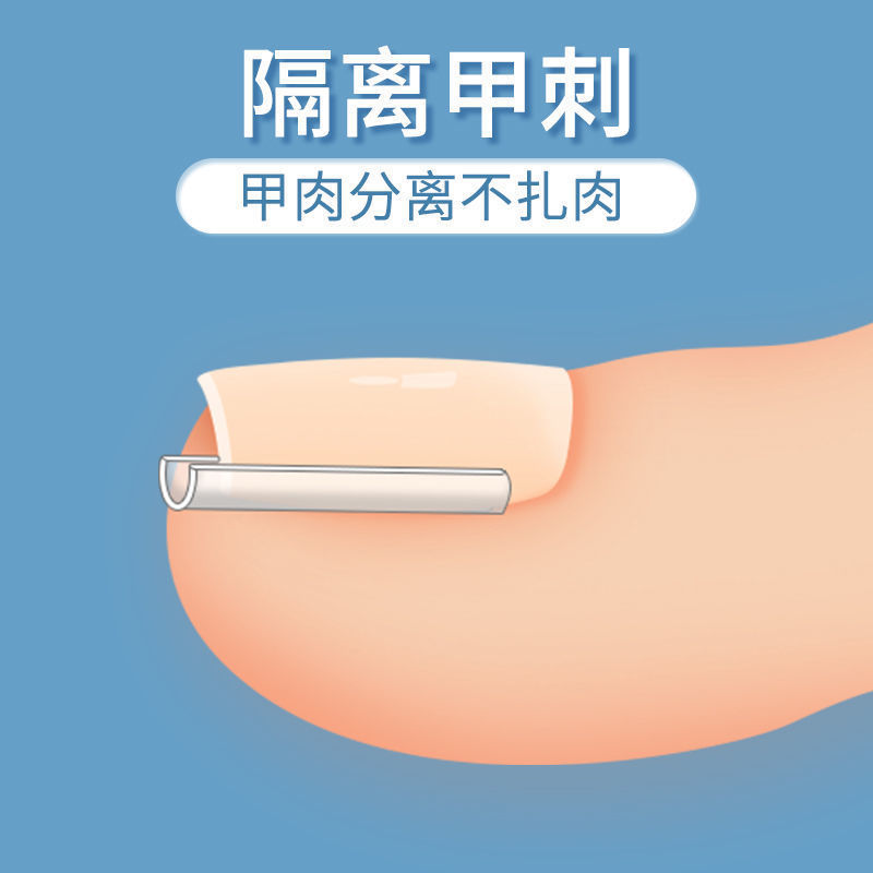 甲溝は甲の矯正器の正甲のパッドを入れて爪を詰めて肉の中に長い隔離パッドを入れて足の爪のパッチ炎を是正します。|undefined