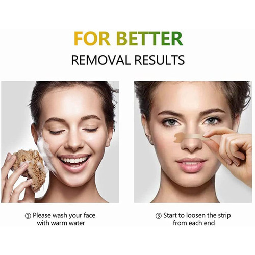 Nasal strip for congestion relief, physically expands nasal passages, improves nasal breathing.