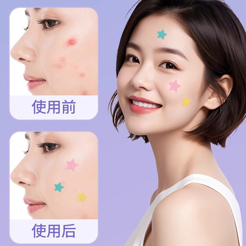 海氏海诺星星创口贴水胶体基材创口贴五角星形状可贴痘痘正品保证
