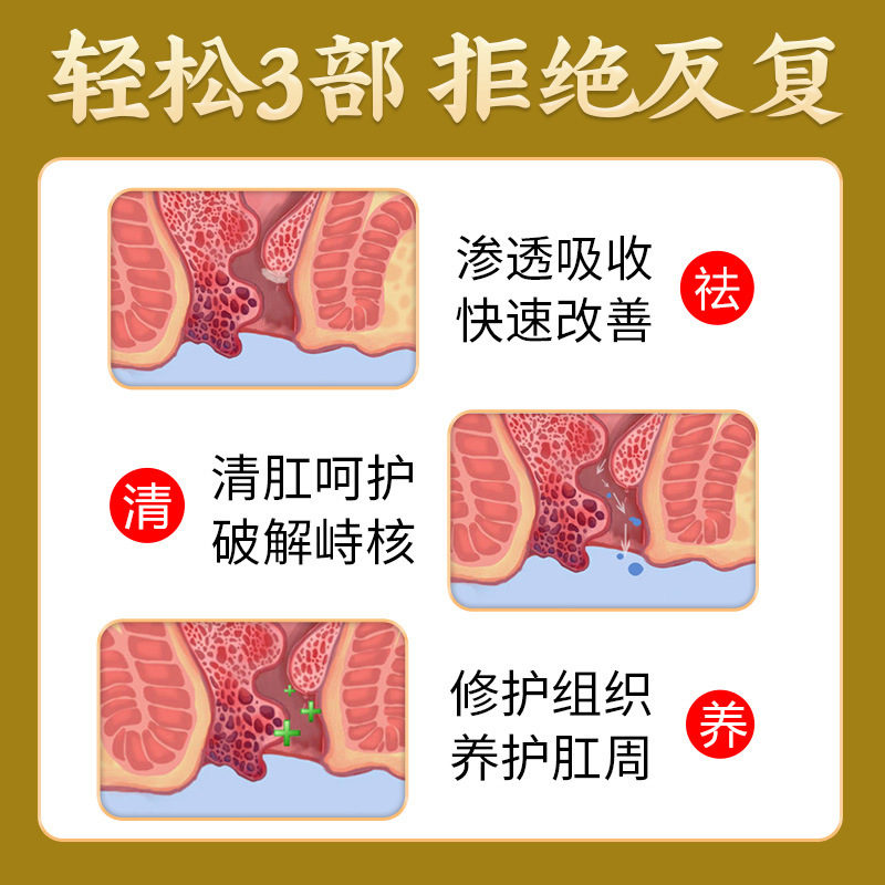 Fujiemebao 痔軟膏 20g 冷湿布ジェル 男女兼用 正規品 華佗痔軟膏 外用鎮静痔軟膏 マイルド|undefined