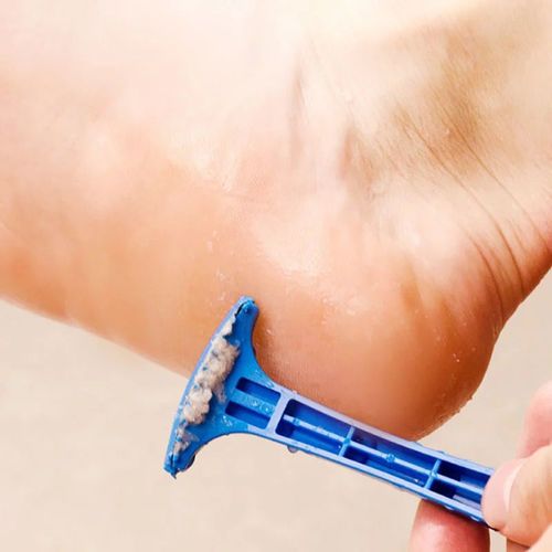 Foot scraper, dead skin removal tool, foot rub knife, heel exfoliation, calluses scraper, foot scraper, foot sole pedicure knife tool