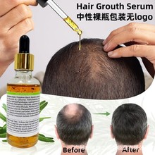 外贸跨境ROSEMARY Hair Growth Oil中性包装无logo护发精油代加工