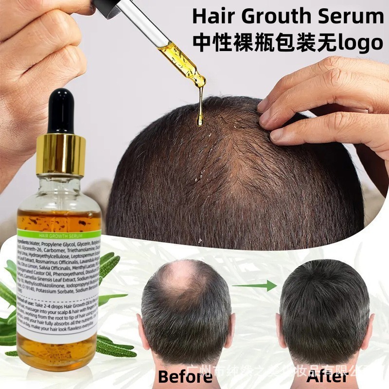 外贸跨境ROSEMARY Hair Growth Oil中性包装无logo护发精油代加工
