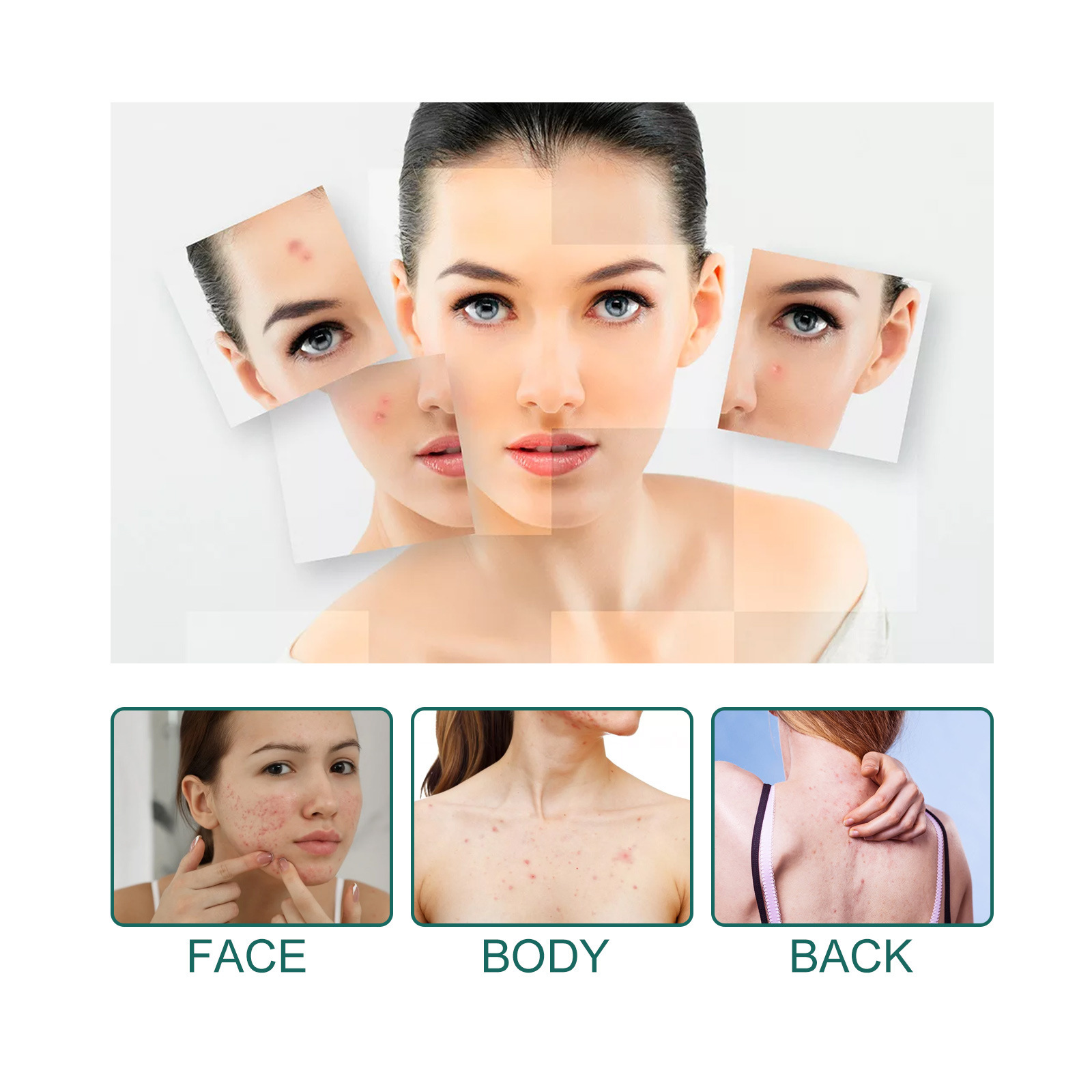 Star shaped patch for lightening spots, marks, cleaning, closing, covering, and repairing acne patches_voghion.com