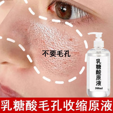 ������ԭҺȥ���^�۴�ƽ����֬��沿�o�����ʹ���ë���տs���A