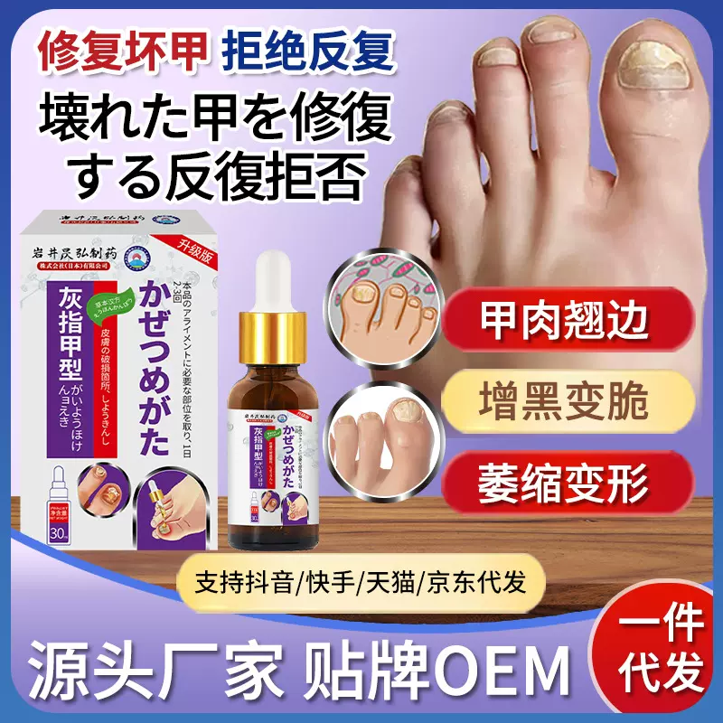 岩井昃弘灰指甲亮甲脱甲增厚发黄专用凤仙花抑菌液冰醋酸工厂直营