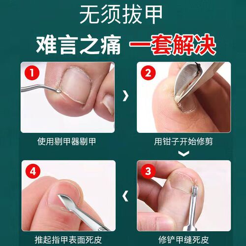 Stainless steel dead skin pliers, nail groove scissors, special toenail scissors, nail clippers, ingrown toenail clippers, hawkbill nail clippers, pedicure set